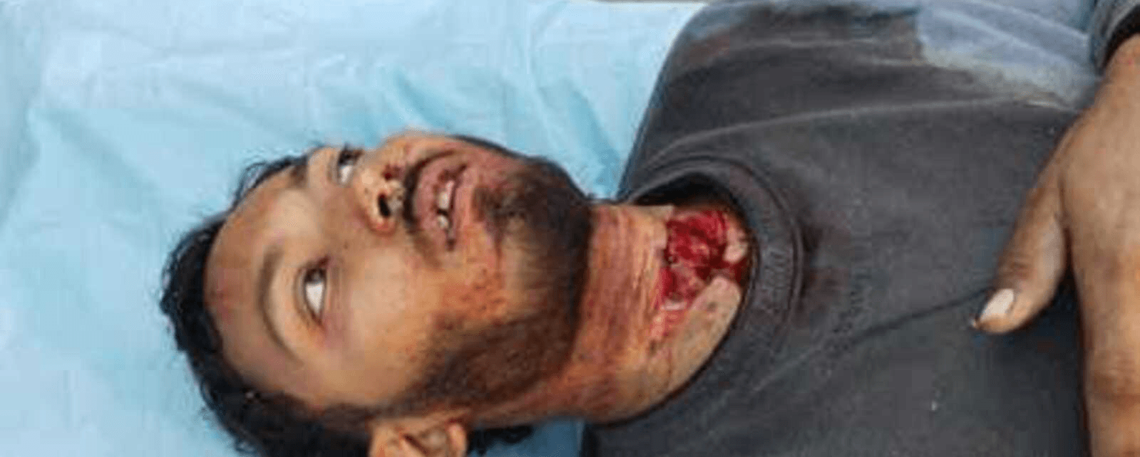 वाराणसी में डिलीवरी बॉय पर जानलेवा हमला: दो नाबालिग आरोपी गिरफ्तार, रंजिश में दी वारदात को अंजाम