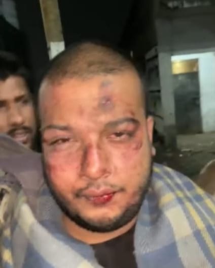 गेवरा खदान में बवाल: दो निजी कंपनियों के कर्मचारियों में भिड़ंत, सुरक्षा कर्मी भी बने शिकार, वीडियो वायरल