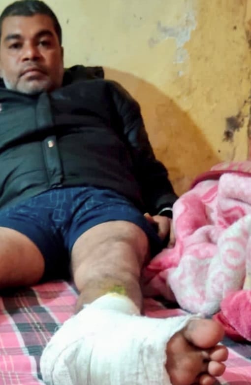 घर लौटते समय हमला: पूर्व जिला युवा कांग्रेस अध्यक्ष को युवकों ने घेरकर पीटा