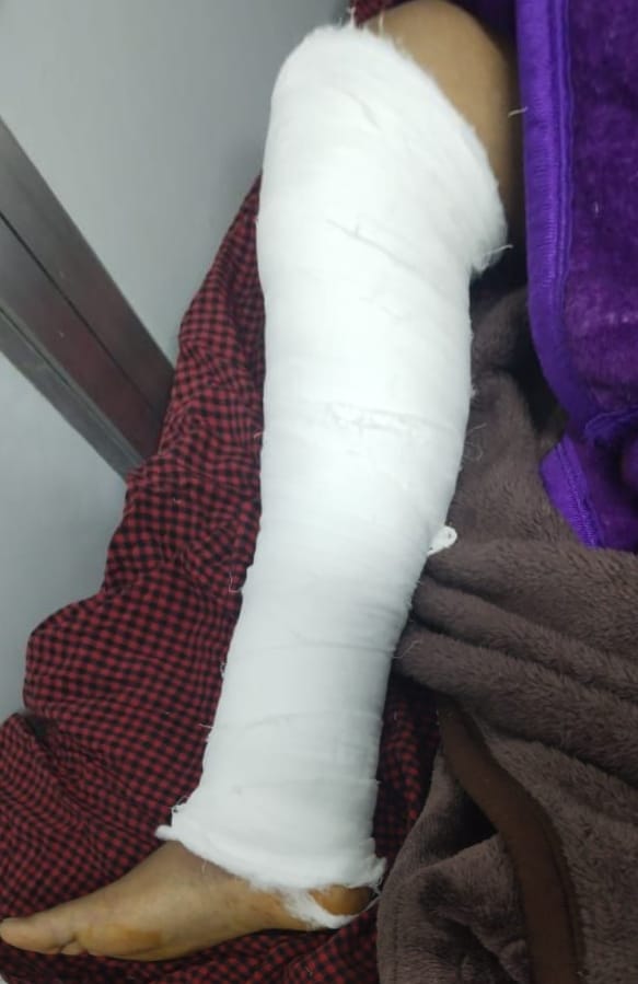 बिलासपुर में हेलमेट चेकिंग के दौरान आरक्षक पर जानलेवा