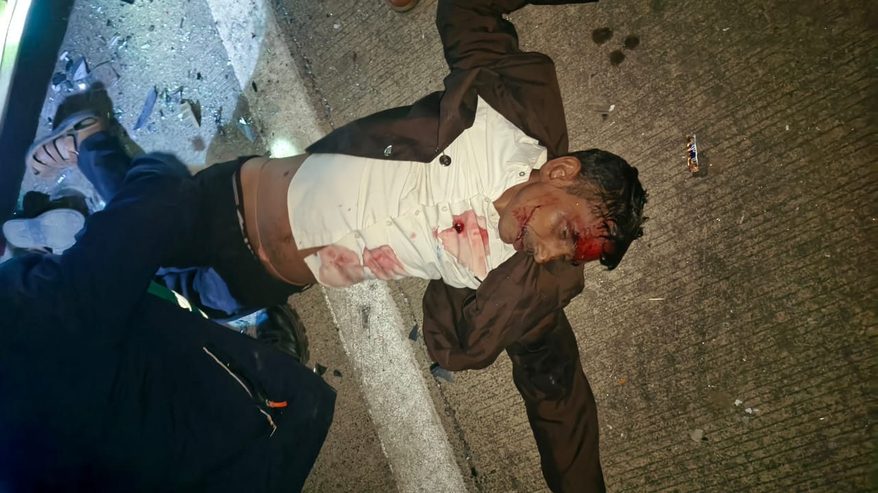 ब्रेकिंग न्यूज़ | कोरबी–मोरगा एनएच-130 पर भीषण सड़क हादसा, दो की दर्दनाक मौत