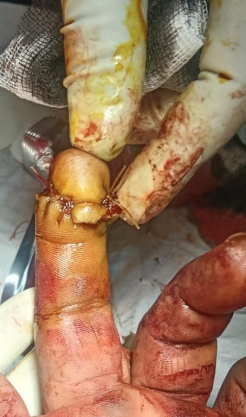 शादी की खुशियों के बीच खून-खराबा, युवक पर धारदार हथियार से हमला