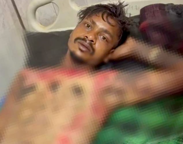 मेला देखने बुलाकर युवक को जलाने की कोशिश, तालाब में कूदकर बची जान