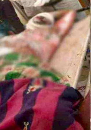 रायगढ़ में युवक को पेट्रोल डालकर जिंदा जलाया, इलाज के दौरान मौत