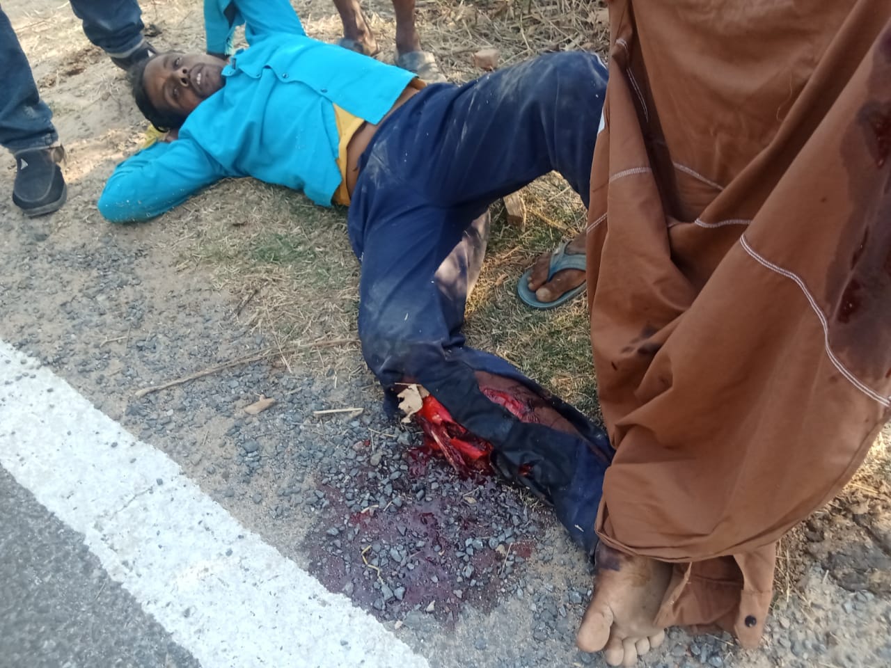 अंधे मोड़ पर तेज रफ्तार ट्रक ने बाइक सवार को मारी टक्कर, युवक का पैर बुरी तरह कुचला