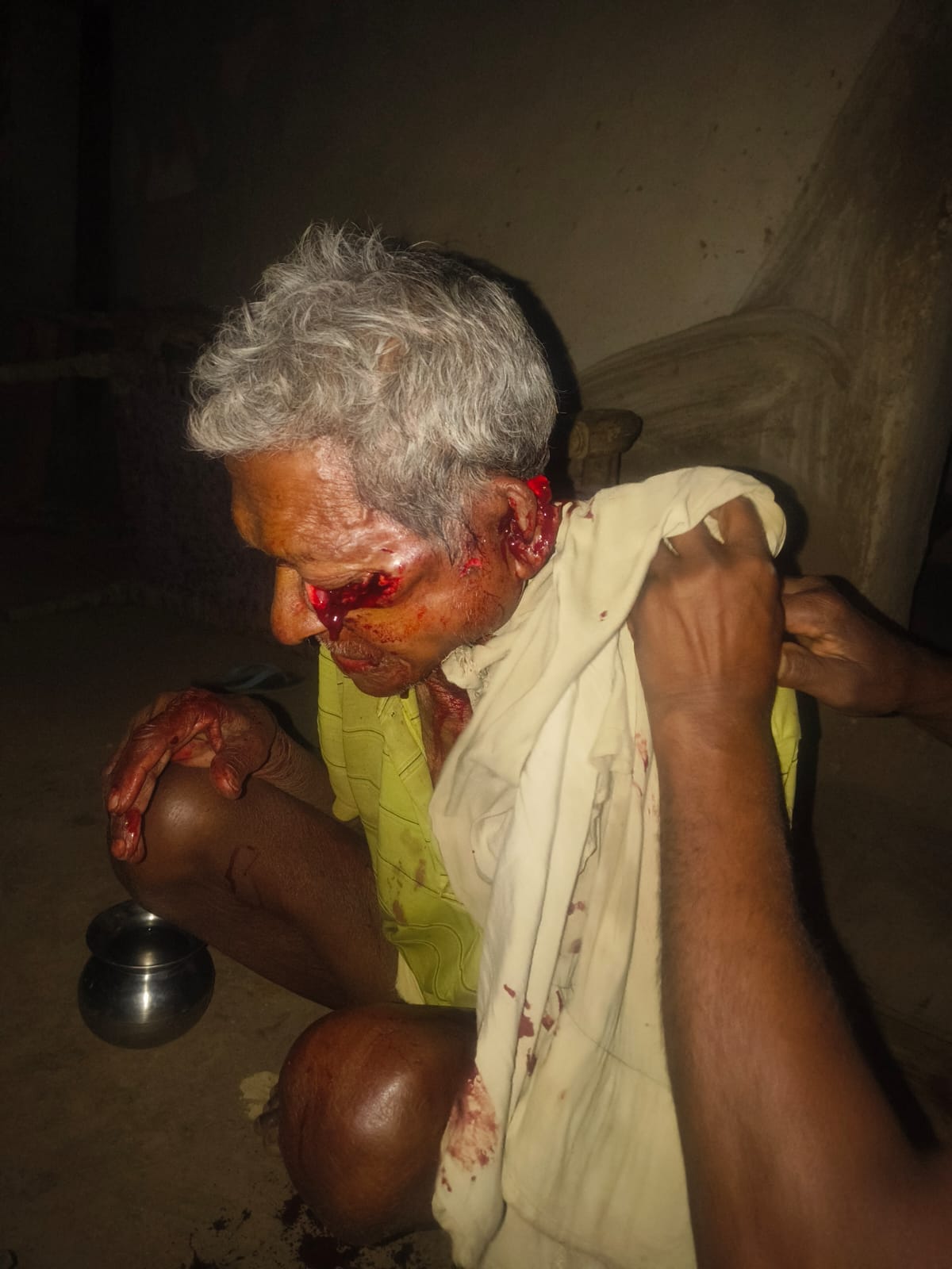 ब्रेकिंग न्यूज अज्ञात हमलावर के वार से 80 वर्षीय वृद्ध गंभीर रूप से घायल, गांव में दहशत