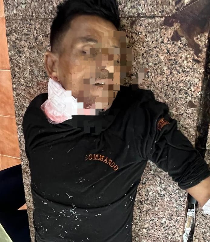 पत्नी के प्रेम-प्रसंग से भड़का पति, प्रेमी की कुल्हाड़ी से हत्या;  पुलिस ने आरोपी को किया गिरफ्तार