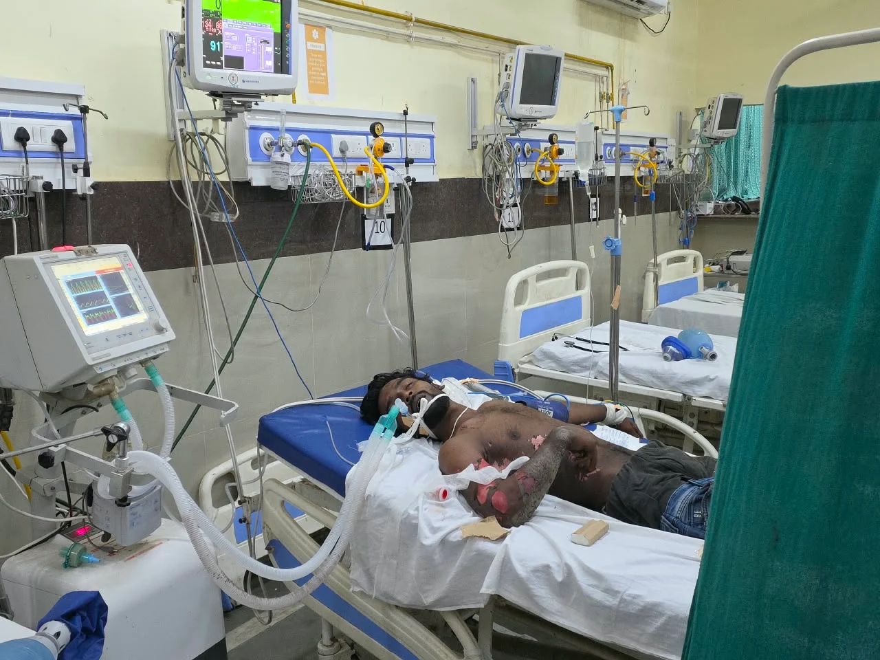 मटकी बांधते समय हाईटेंशन तार की चपेट में आया युवक, गंभीर रूप से झुलसा